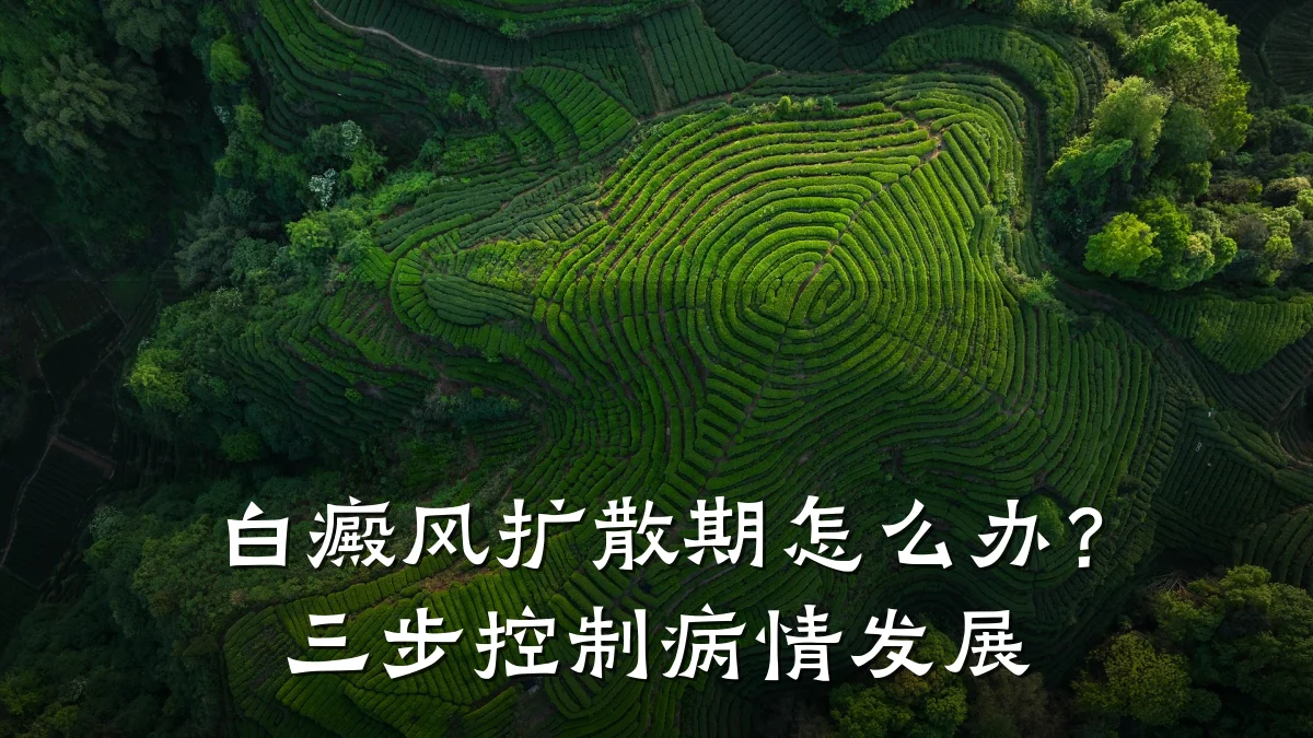 白癜风扩散期怎么办?三步控制病情发展